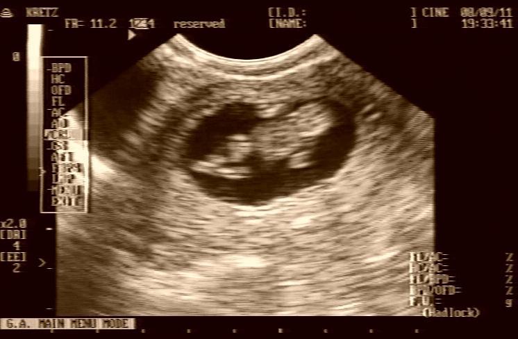 Kismukk-20080911-print.jpg